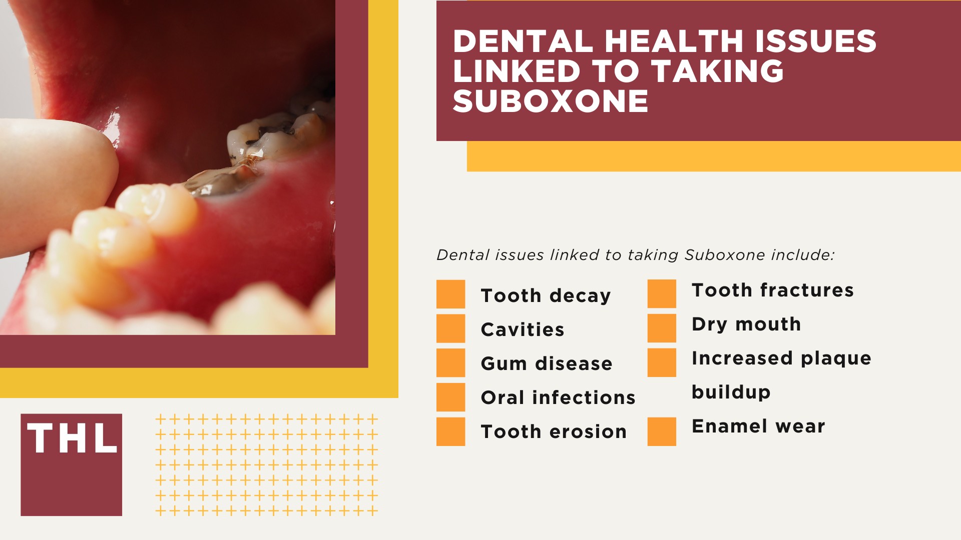 Overview of the Suboxone Lawsuits for Tooth Decay and Dental Injuries; Dental Health Issues Linked to Taking Suboxone