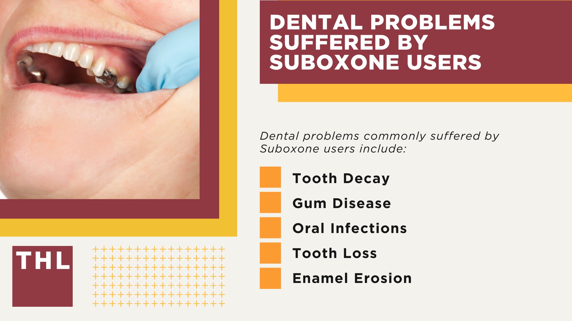 Factors Affecting the Filing of Suboxone Tooth Decay Lawsuits; A General Overview of the Suboxone Tooth Decay Lawsuits; Dental Problems Suffered by Suboxone Users