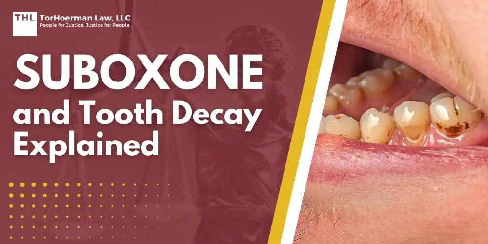 Suboxone and Tooth Decay Explained