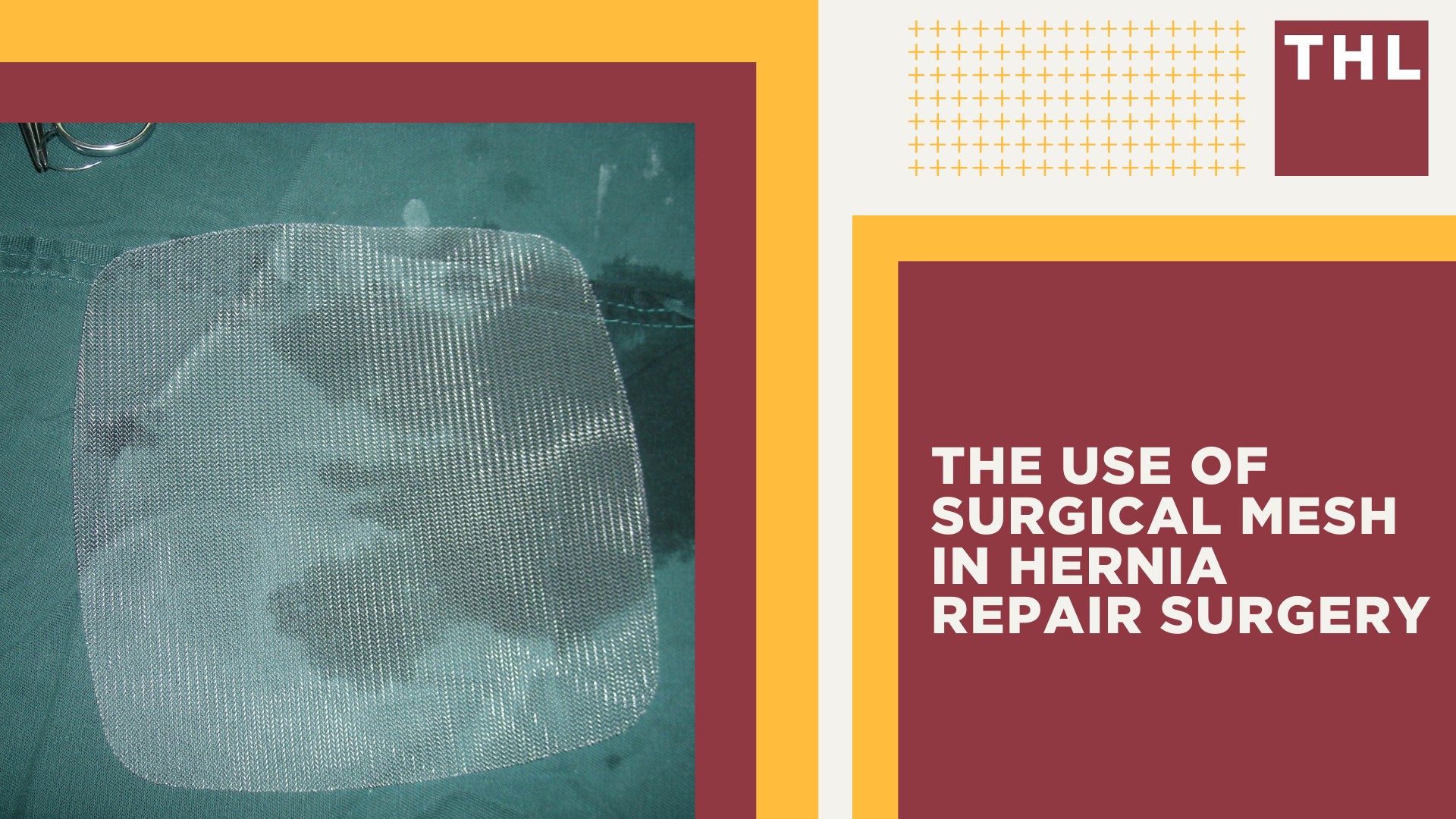 The Use of Surgical Mesh in Hernia Repair Surgery