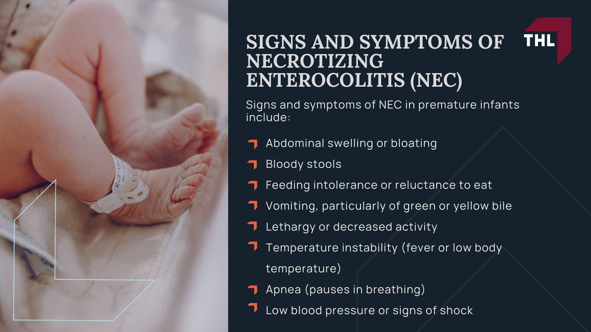 Qualifying Factors for NEC Baby Formula Lawsuits; An Overview of the NEC Baby Formula Lawsuit; Qualifying Factors for NEC Baby Formula Lawsuits; An Overview of the NEC Baby Formula Lawsuit; TorHoerman Law Obtains Landmark $495 Million Verdict Against Abbott Laboratories in NEC Baby Formula Trial; Necrotizing Enterocolitis (NEC) Explained; Signs and Symptoms of Necrotizing Enterocolitis (NEC)
