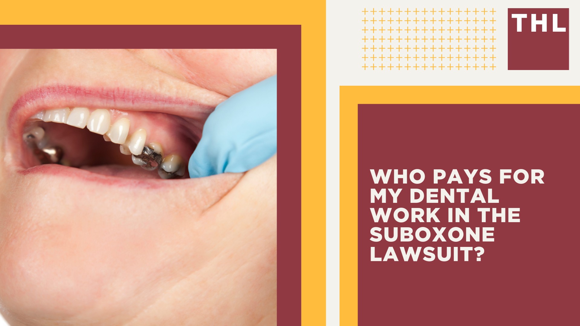 Suboxone Linked to Tooth Decay and Other Dental Injuries; Suboxone Tooth Decay Lawsuits Filed in Federal Court; Who Pays for My Dental Work in the Suboxone Lawsuit