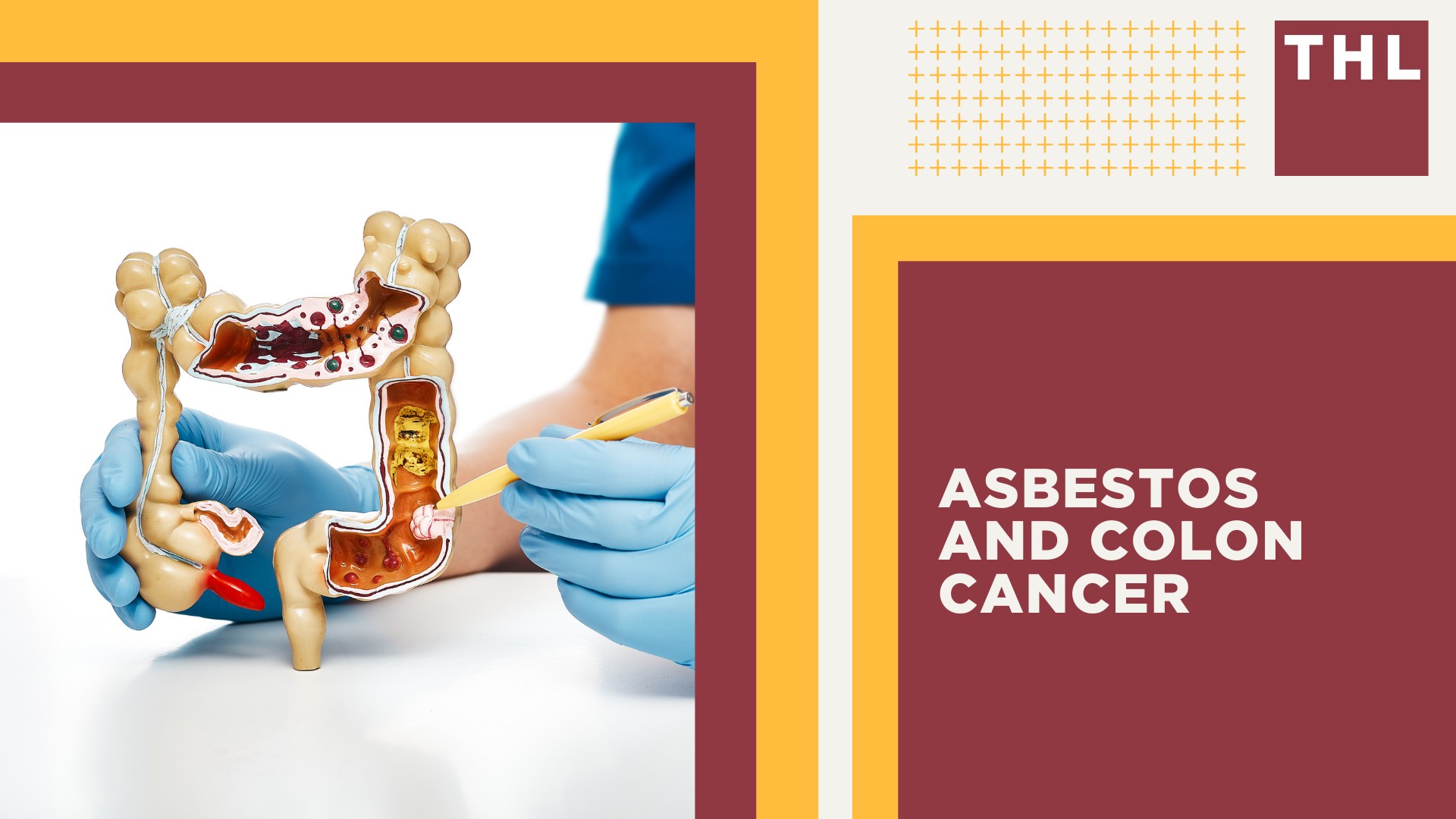 Understanding Asbestos Exposure; Asbestos and Colon Cancer