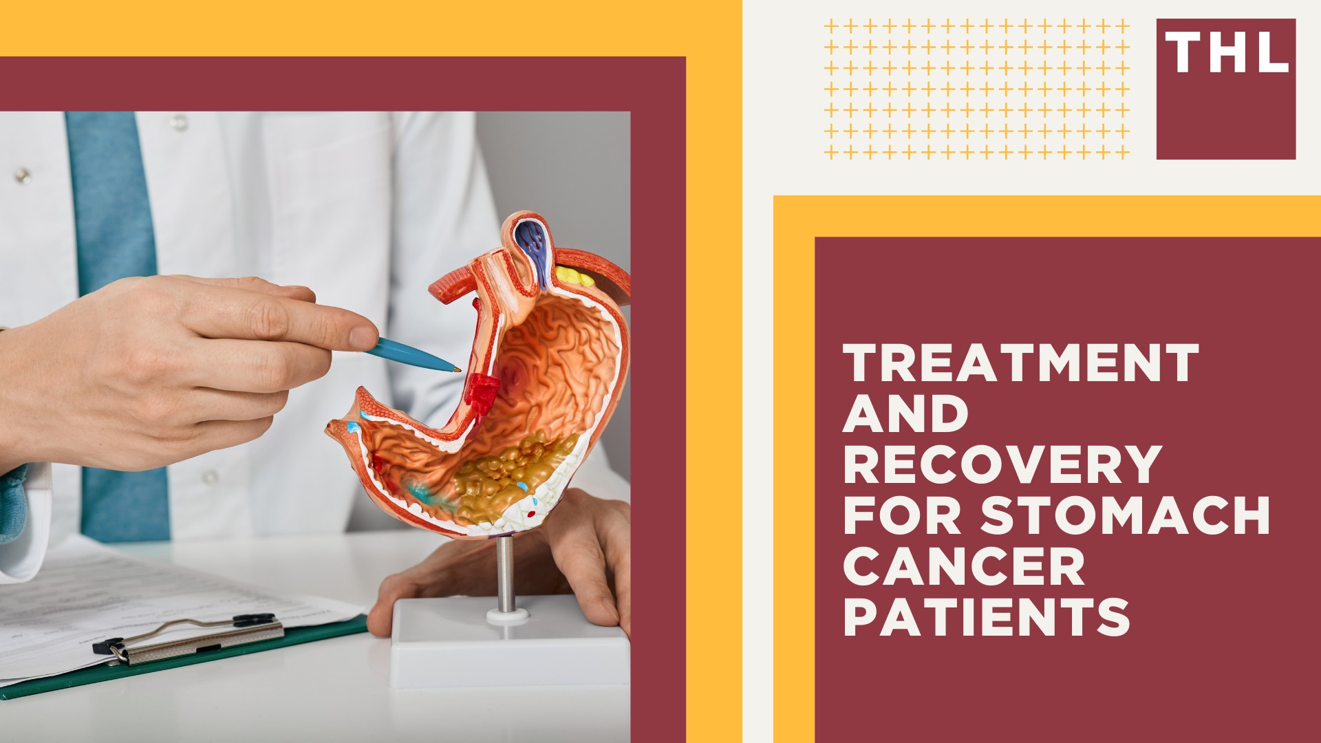 What You Need To Know About Asbestos Exposure; Asbestos and Gastrointestinal Cancer; Treatment and Recovery for Stomach Cancer Patients