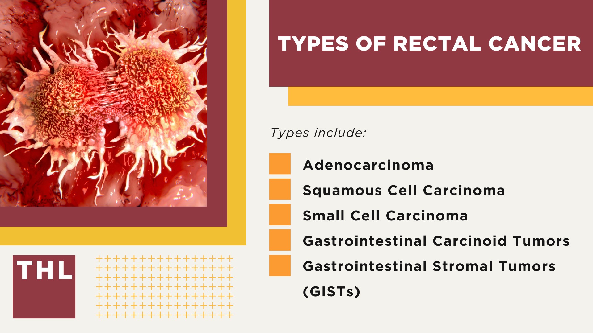 Understanding Asbestos and Exposure; What Is Asbestos; Asbestos and Rectal Cancer_ The Scientific Link; Symptoms of Rectal Cancer; Diagnostic Procedures for Rectal Cancer; Types of Rectal Cancer