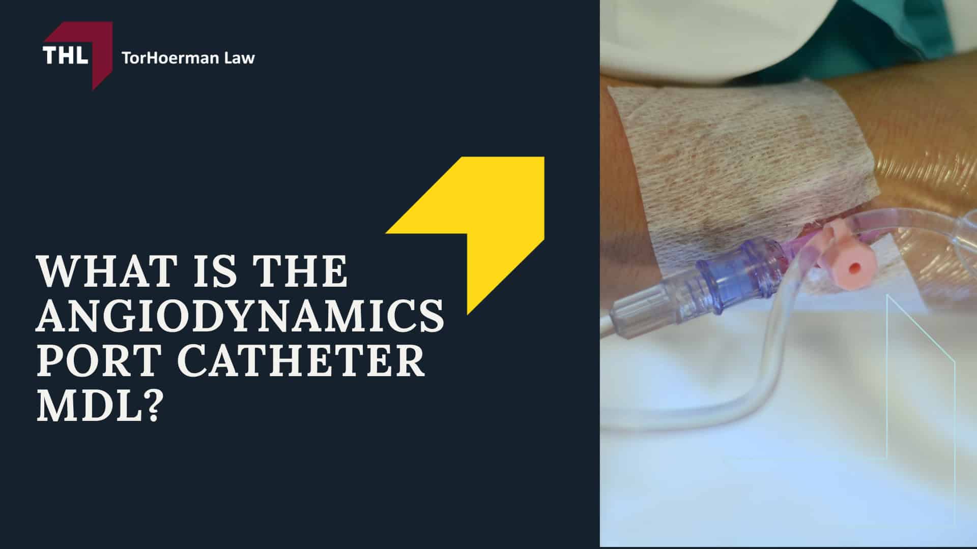 AngioDynamics Port Catheter Lawsuit - An Overview of the AngioDynamics Port Catheter Lawsuit - torhoerman law; AngioDynamics Port Catheter Lawsuit - What is the AngioDynamics Port Catheter MDL - torhoerman law