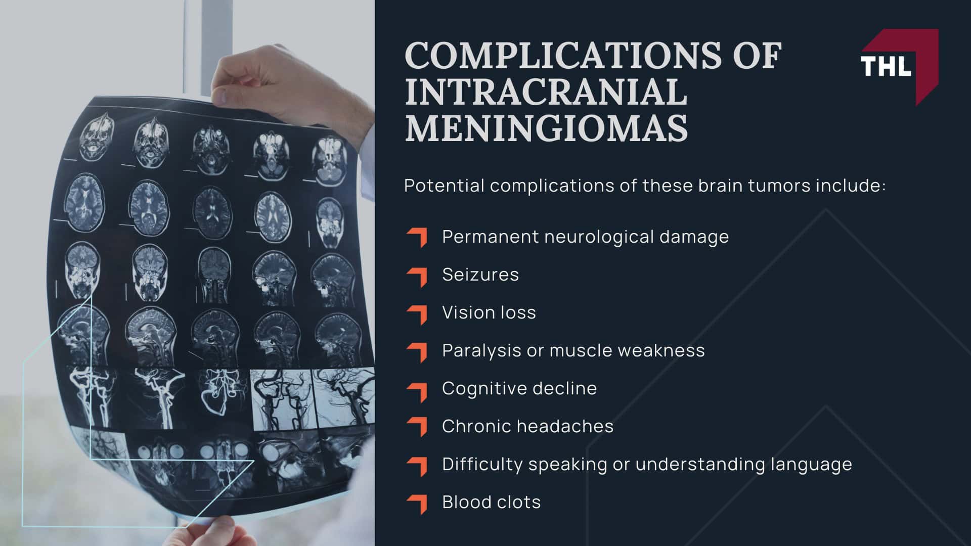 ESTIMATED DEPO-PROVERA LAWSUIT SETTLEMENT AMOUNTS - DEPO-PROVERA LAWSUIT SETTLEMENT AMOUNT - DEPO-PROVERA LAWSUIT - TORHOERMAN LAW; ESTIMATED DEPO-PROVERA LAWSUIT SETTLEMENT AMOUNTS - DEPO-PROVERA LAWSUIT SETTLEMENT AMOUNT - DEPO-PROVERA LAWSUIT - TORHOERMAN LAW (1); HOW MIGHT DEPO PROVERA SETTLEMENT AMOUNTS BE DETERMINED - DEPO-PROVERA LAWSUIT SETTLEMENT AMOUNT - DEPO-PROVERA LAWSUIT - TORHOERMAN LAW; DEPO-PROVERA LITIGATION OVERVIEW - DEPO-PROVERA LAWSUIT SETTLEMENT AMOUNT - DEPO-PROVERA LAWSUIT - TORHOERMAN LAW; Scientific Study Links the Use of Depo-Provera to Brain Tumors; SYMPTOMS OF INTRACRANIAL MENINGIOMAS - DEPO-PROVERA LAWSUIT SETTLEMENT AMOUNT - DEPO-PROVERA LAWSUIT - TORHOERMAN LAW; COMPLICATIONS OF INTRACRANIAL MENINGIOMAS - DEPO-PROVERA LAWSUIT SETTLEMENT AMOUNT - DEPO-PROVERA LAWSUIT - TORHOERMAN LAW