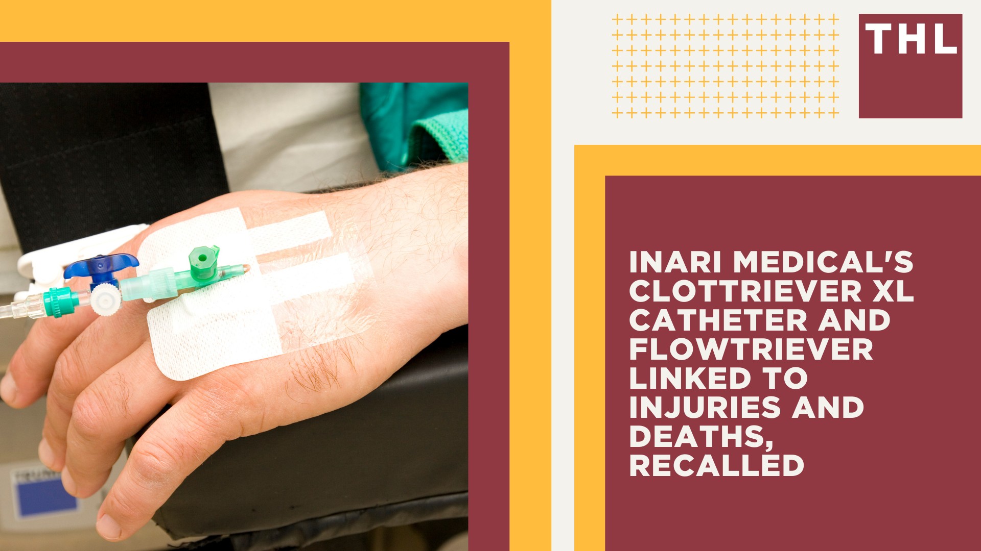 Inari Medical's ClotTriever XL Catheter and FlowTriever Linked to Injuries and Deaths, Recalled