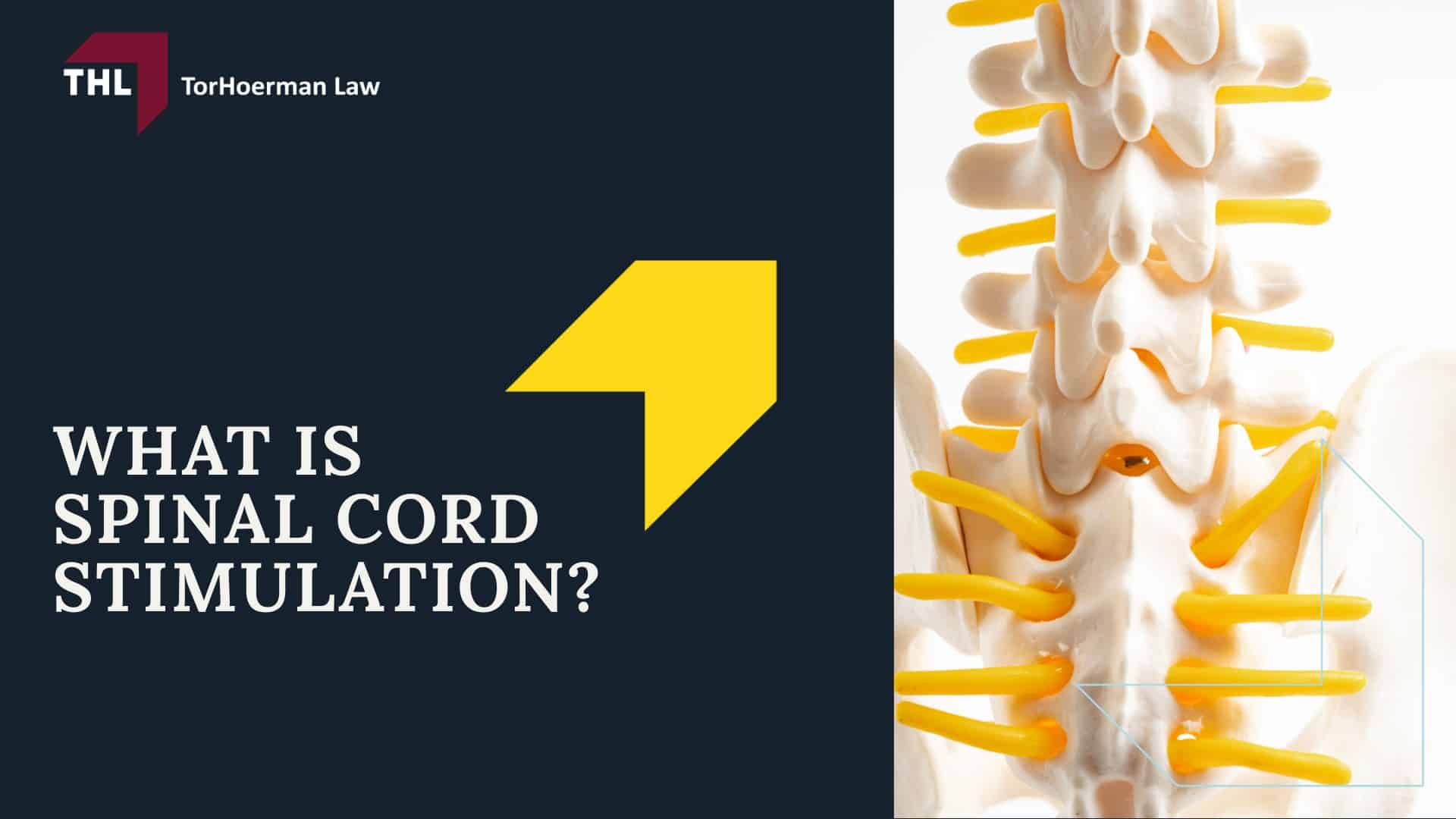 Spinal Cord Stimulator Lawsuit - Spinal Cord Stimulator Lawsuit Overview - torhoerman law; Spinal Cord Stimulator Lawsuit - Spinal Cord Stimulator Injury Risks - torhoerman law; Spinal Cord Stimulator Lawsuit - What is Spinal Cord Stimulation - torhoerman law