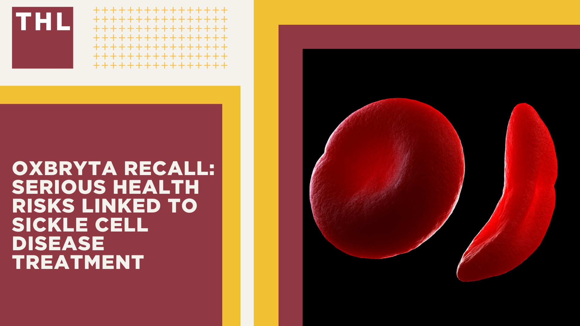 Settlement Projections for Oxbryta Lawsuits; Overview of the Oxbryta Lawsuit Investigation; Oxbryta Recall_ Serious Health Risks Linked to Sickle Cell Disease Treatment
