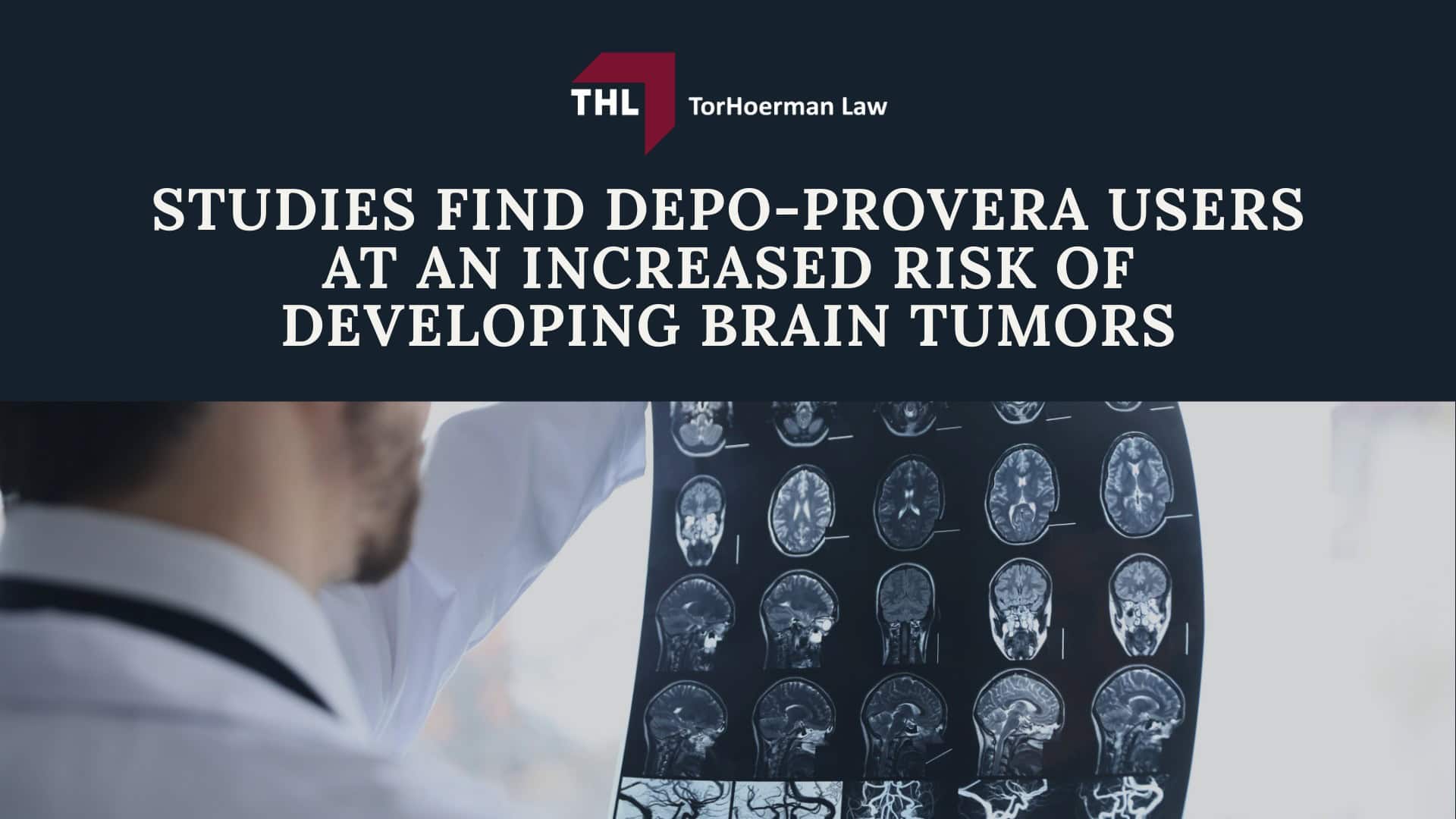 WHAT IS THE NEW LAWSUIT FOR DEPO-PROVERA - DEPO-PROVERA LAWSUIT- TORHOERMAN LAW; AN OVERVIEW OF THE NEW DEPO-PROVERA LAWSUIT -WHAT IS THE NEW LAWSUIT FOR DEPO-PROVERA - DEPO-PROVERA LAWSUIT- TORHOERMAN LAW; PROJECTIONS FOR DEPO-PROVERA SETTLEMENTS -WHAT IS THE NEW LAWSUIT FOR DEPO-PROVERA - DEPO-PROVERA LAWSUIT- TORHOERMAN LAW; WHY IS THERE A NEW DEPO-PROVERA LAWSUIT FILED -WHAT IS THE NEW LAWSUIT FOR DEPO-PROVERA - DEPO-PROVERA LAWSUIT- TORHOERMAN LAW; Studies Find Depo-Provera Users at an Increased Risk of Developing Brain Tumors