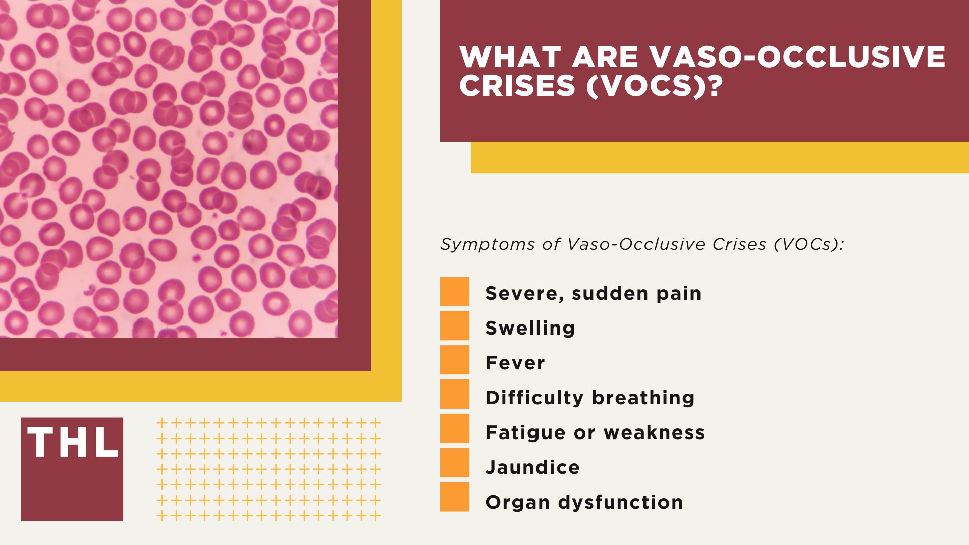 Settlement Projections for Oxbryta Lawsuits; Overview of the Oxbryta Lawsuit Investigation; Oxbryta Recall_ Serious Health Risks Linked to Sickle Cell Disease Treatment; What are Vaso-Occlusive Crises (VOCs)