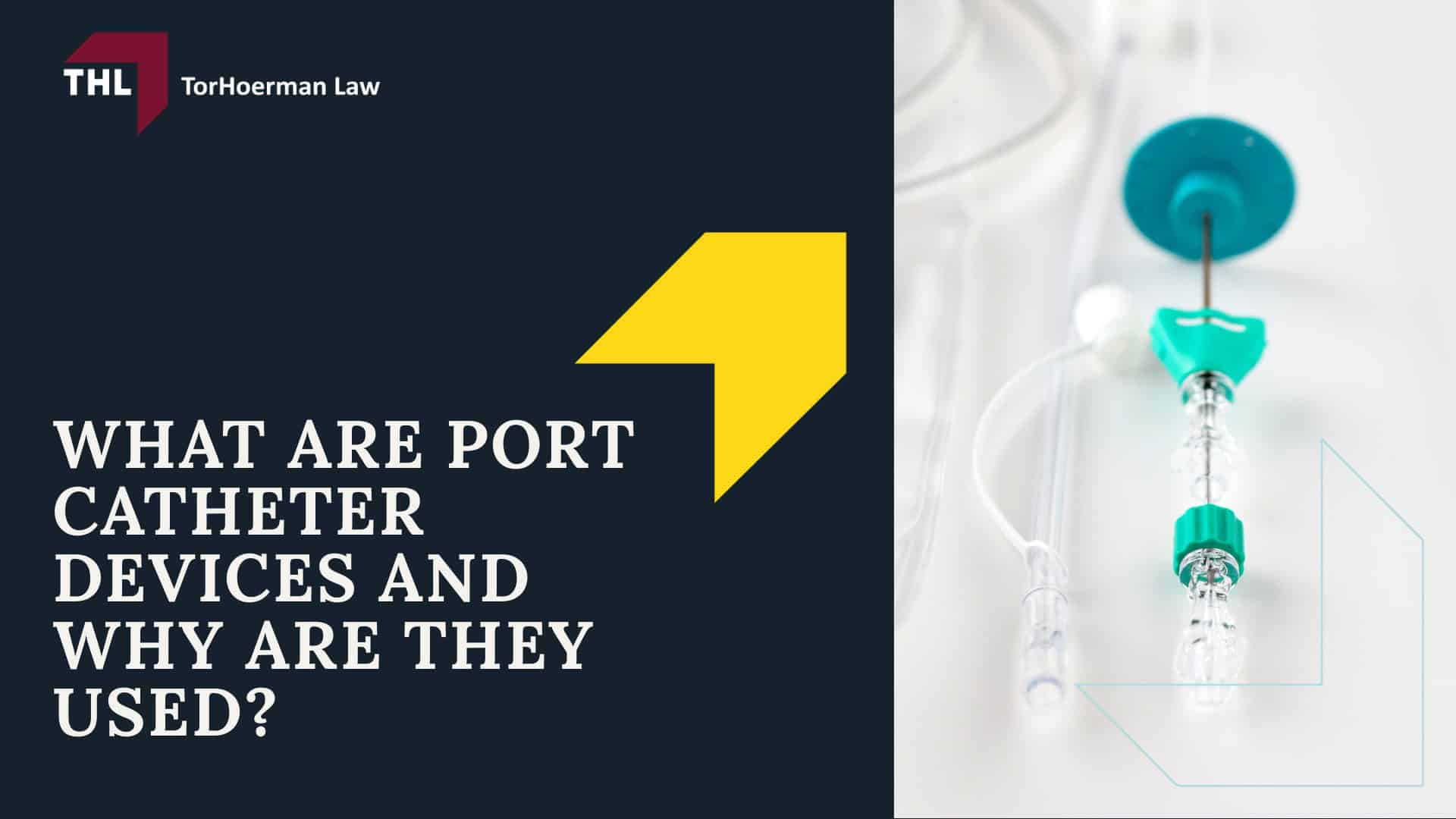 Projected AngioDynamics Port Catheter Lawsuit Settlement Amounts; AngioDynamics Port Catheter Linked to Severe Complications; What are Port Catheter Devices and Why are they Used?