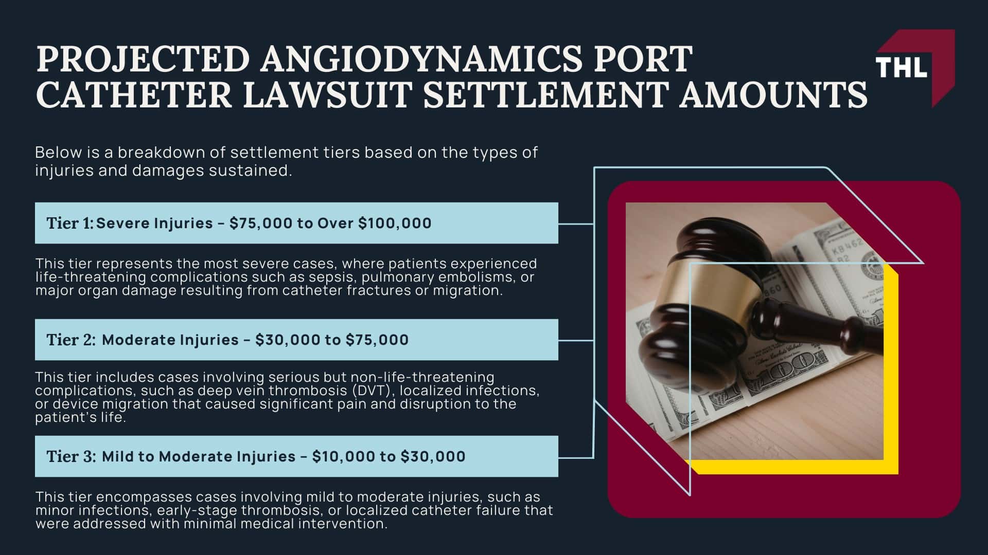 Projected AngioDynamics Port Catheter Lawsuit Settlement Amounts