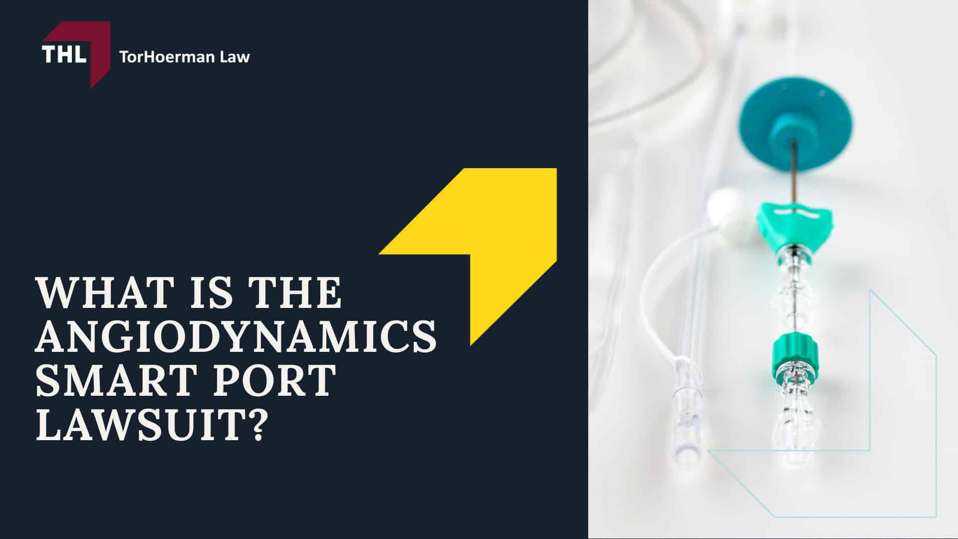 AngioDynamics Smart Port Lawsuit - What is the AngioDynamics Smart Port Lawsuit - torhoerman law