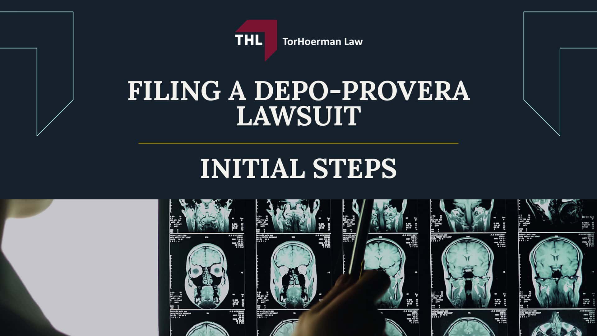 What You Need to Know Before Filing a Depo-Provera Lawsuit; The Basis of the Depo-Provera Brain Tumor Lawsuit; Scientific Evidence Links Depo-Provera to an Increased Risk of Developing Brain Tumors; The Role of a Depo-Provera Lawyer Explained; The Process for Legal Claims in the Depo-Provera Lawsuit;  IS THERE A DEPO-PROVERA CLASS ACTION LAWSUIT -; Filing a Depo-Provera Lawsuit: Initial Steps
