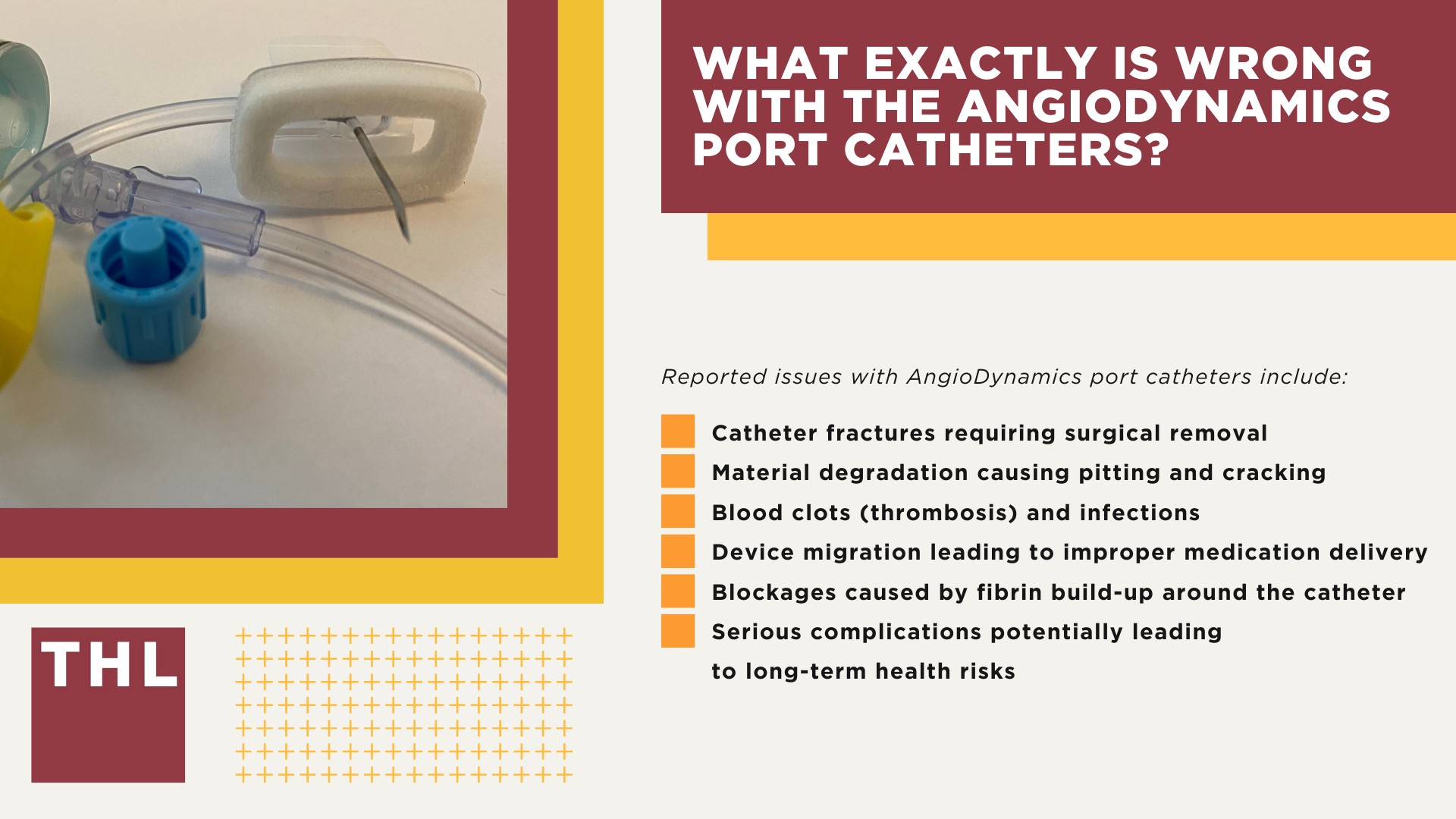 Projected AngioDynamics Port Catheter Lawsuit Settlement Amounts; AngioDynamics Port Catheter Linked to Severe Complications; What AngioDynamics Port Catheters are Under Legal Investigation; What Exactly is Wrong with the AngioDynamics Port Catheters