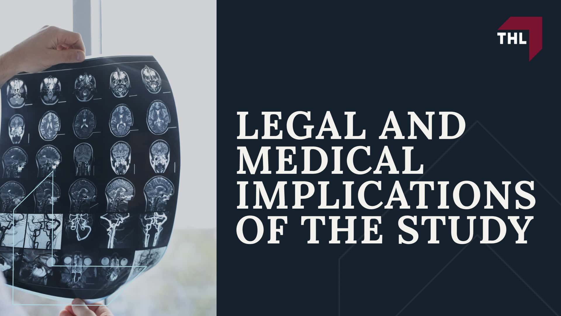 2024 Scientific Study: Depo-Provera Users at Increased Risk of Developing Brain Tumors;