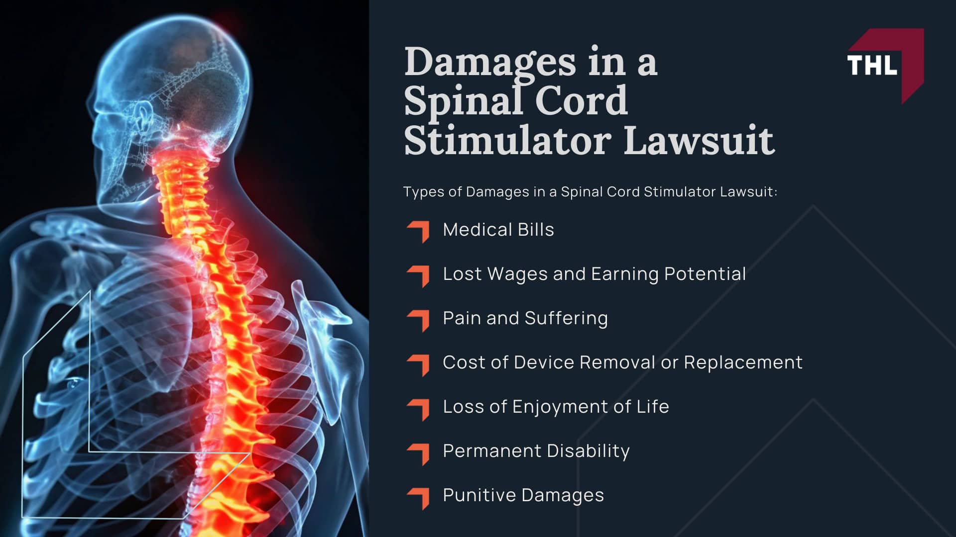 Suffer Injuries After Spinal Cord Stimulator Implantation? You May Be Eligible for Legal Action; Who Qualifies for a Spinal Stimulator Lawsuit - Types of Spinal Cord Stimulator Injuries and Their Causes - torhoerman law; Do You Qualify for a Spinal Cord Stimulator Lawsuit?; Who Qualifies for a Spinal Stimulator Lawsuit - Gathering Evidence for a Spinal Stimulator Lawsuit - torhoerman law; Who Qualifies for a Spinal Stimulator Lawsuit - Damages in a Spinal Cord Stimulator Lawsuit - torhoerman law