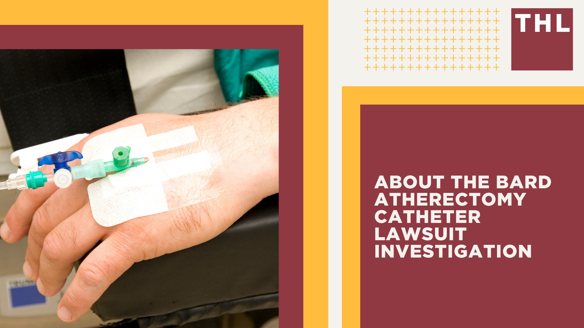 About the Bard Atherectomy Catheter Lawsuit Investigation