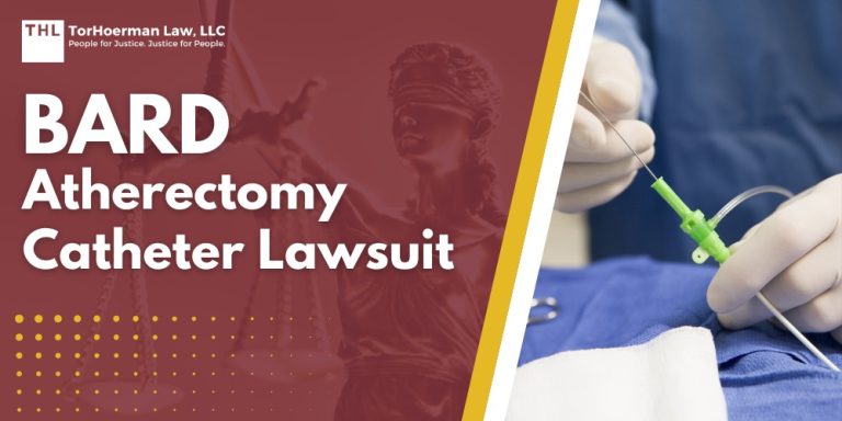 Bard Atherectomy Catheter Lawsuit; About the Bard Atherectomy Catheter Lawsuit Investigation; Bard Peripheral Vascular Recall Overview; Complications and Injuries Linked to Bard Atherectomy Catheter Devices; Current Lawsuits Against Bard Peripheral Vascular; Do You Qualify for a Rotarex Atherectomy System Lawsuit; TorHoerman Law_ Investigating Potential Bard Atherectomy Catheter Lawsuits