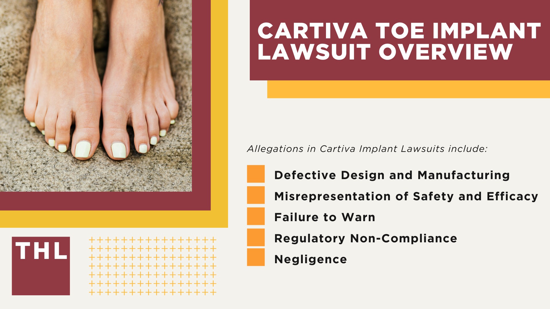 Cartiva Toe Implant Lawsuit Overview