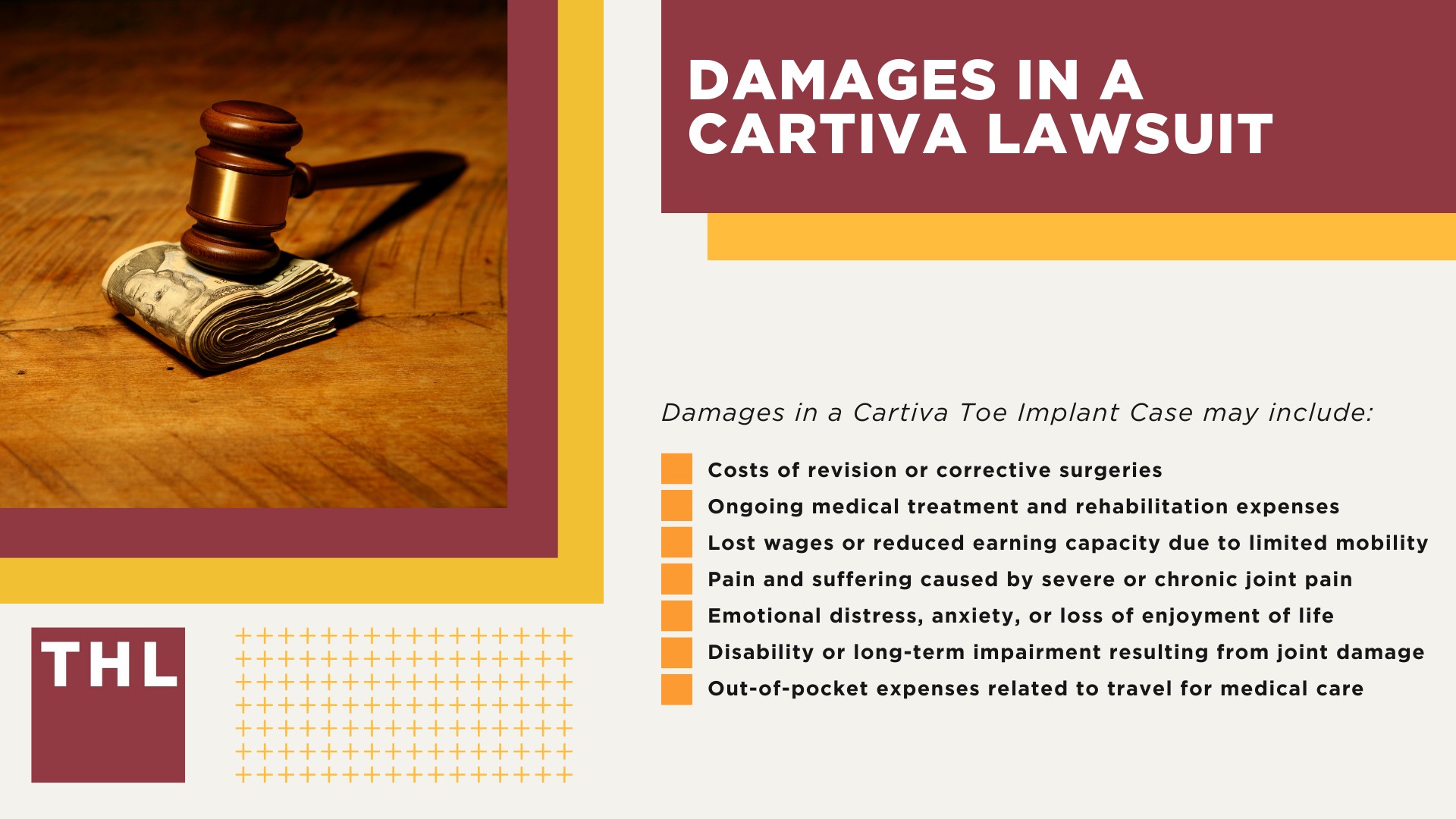 Cartiva Toe Implant Lawsuit Overview; Injuries Linked to Cartiva Implant Device Failures; Cartiva Implant Failure Symptoms; Do You Qualify for the Cartiva Implant Lawsuit; Gathering Evidence for Cartiva Implant Failure Lawsuits; Damages in a Cartiva Lawsuit