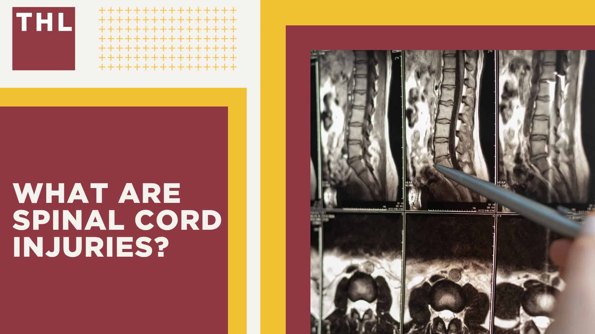 Meet Our Team of Atlanta Spinal Cord Injury Lawyers; Our Founder_ Tor Hoerman; What Are Spinal Cord Injuries