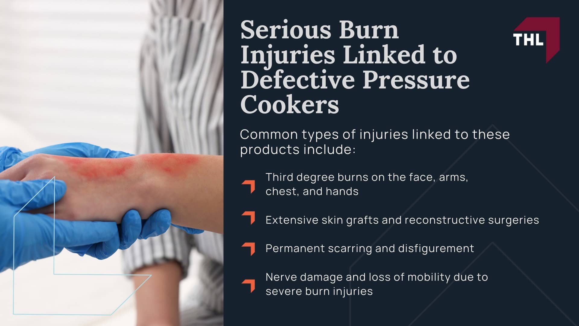 Ambiano Pressure Cooker Lawsuit - Ambiano Pressure Cooker Recall Overview - torhoerman law; Ambiano Pressure Cooker Lawsuit - Serious Burn Injuries Linked to Defective Pressure Cookers - torhoerman law