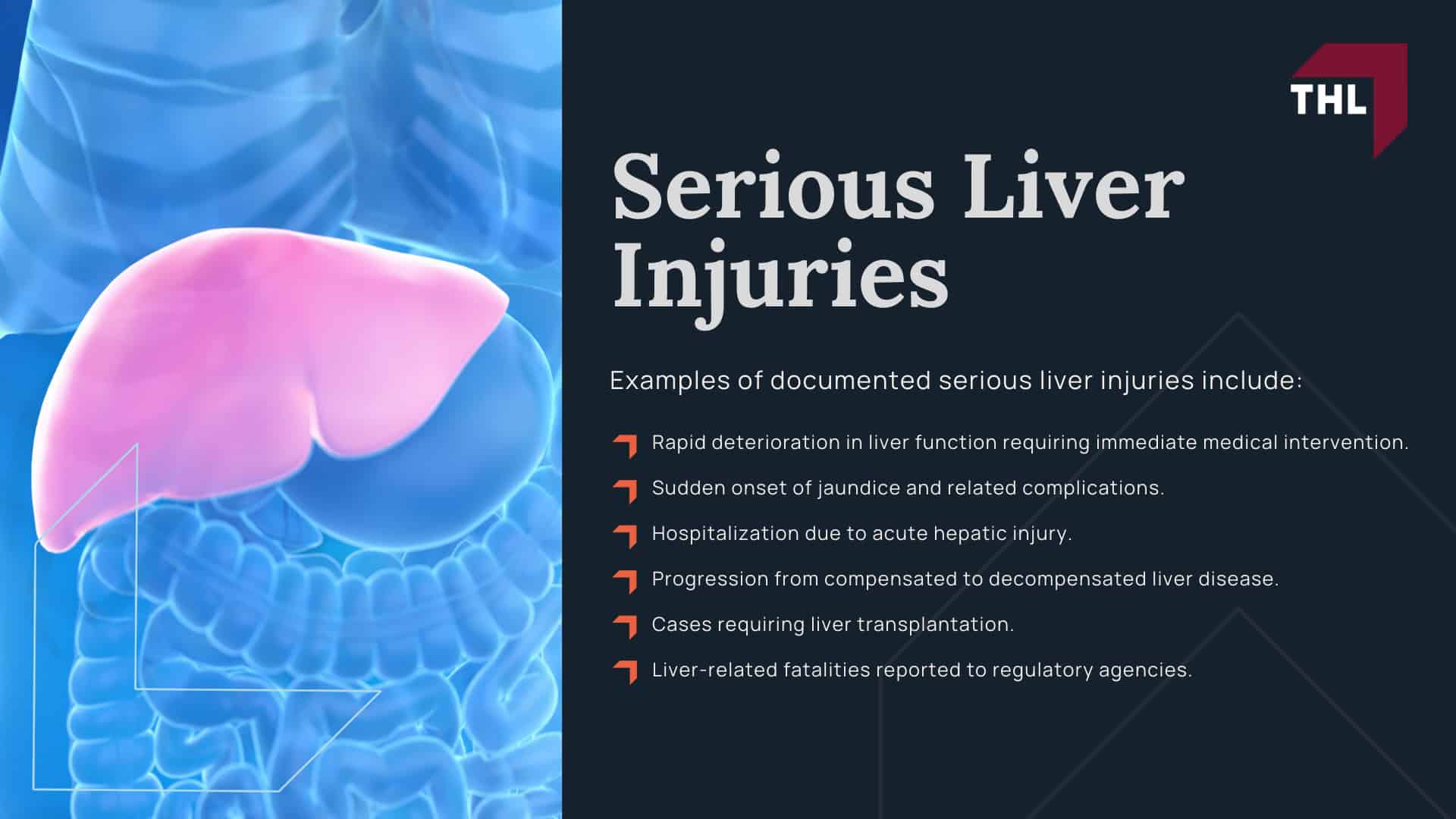 Ocaliva Lawsuit - Ocaliva Lawsuit Investigation Overview - torhoerman law; Ocaliva Lawsuit - Why Was Ocaliva Withdrawn from the US Commercial Market - torhoerman law; Ocaliva Lawsuit - Ocaliva Side Effects and Documented Injuries - torhoerman law; Ocaliva Lawsuit - Serious Liver Injuries - torhoerman law